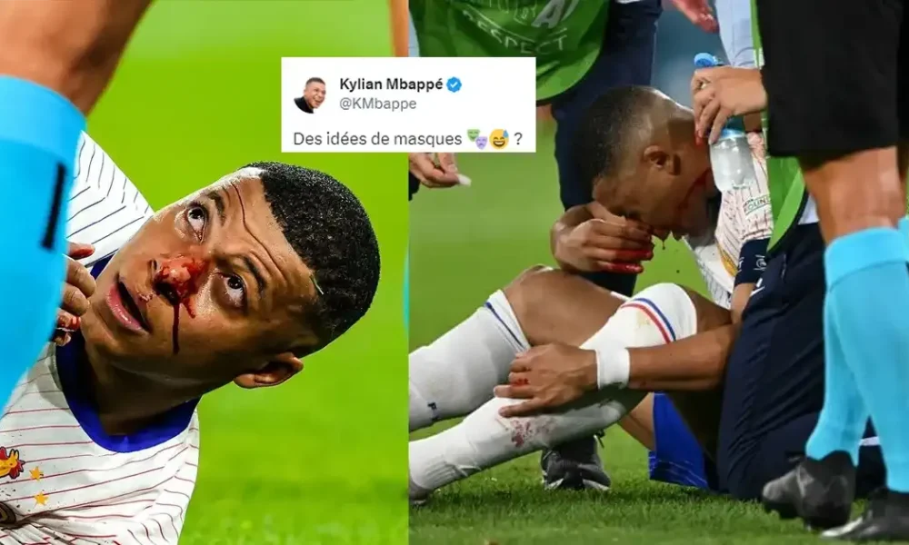 Osimhen Other Footballers Who Wore Face Mask Before Kylian Mbappe