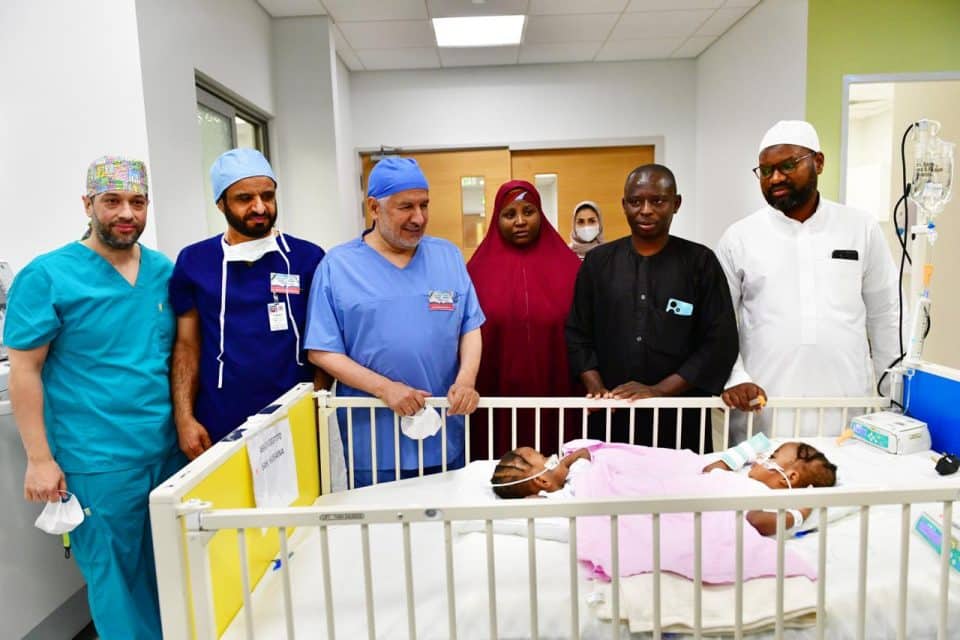 Saudi Medical Experts Successfully Separate Conjoined Twins From Kano