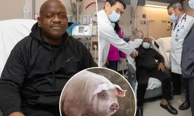 62-Year-Old Man Who Underwent First-Ever Modified Pig Kidney Transplant Is Dead