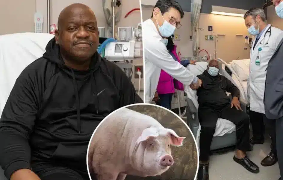 62-Year-Old Man Who Underwent First-Ever Modified Pig Kidney Transplant Is Dead