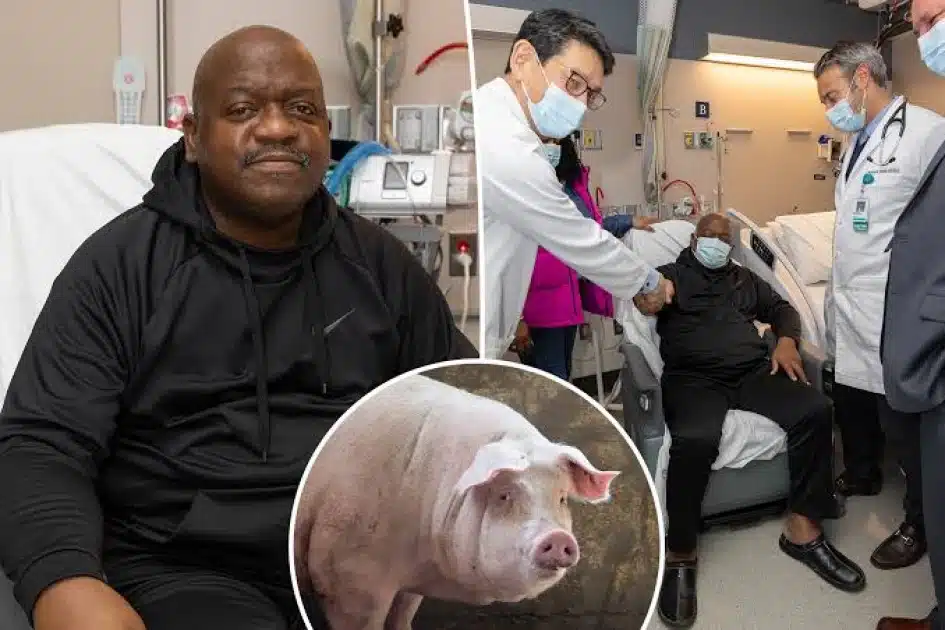 62-Year-Old Man Who Received First-Ever Modified Pig Kidney Transplant Is  Dead